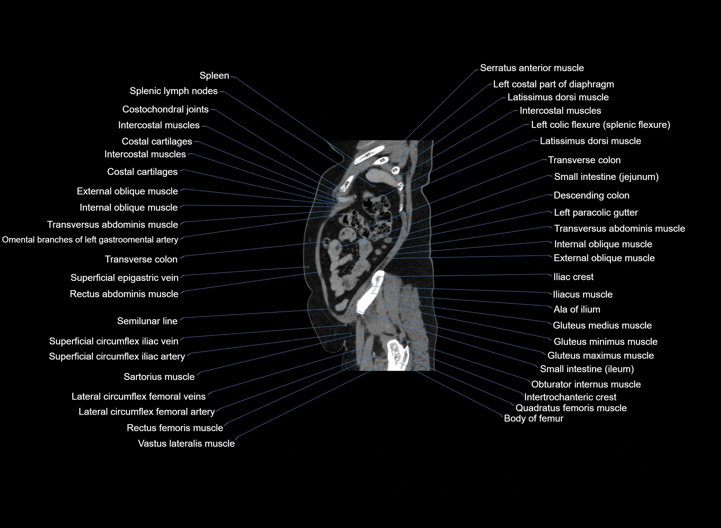 CT Abdomen sagittal cross sectional anatomy labelled radiology image -00019.webp